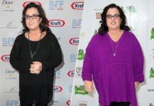 Rosie O'donnell Post Sleeve Surgery