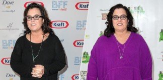 Rosie O'donnell Post Sleeve Surgery