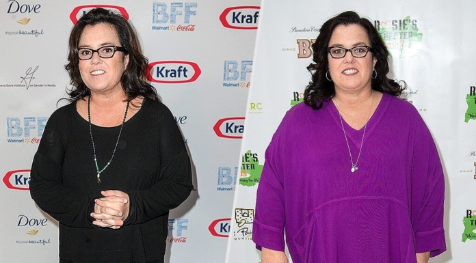 Rosie O'donnell Post Sleeve Surgery