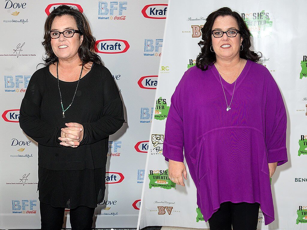 Rosie O'donnell Post Sleeve Surgery